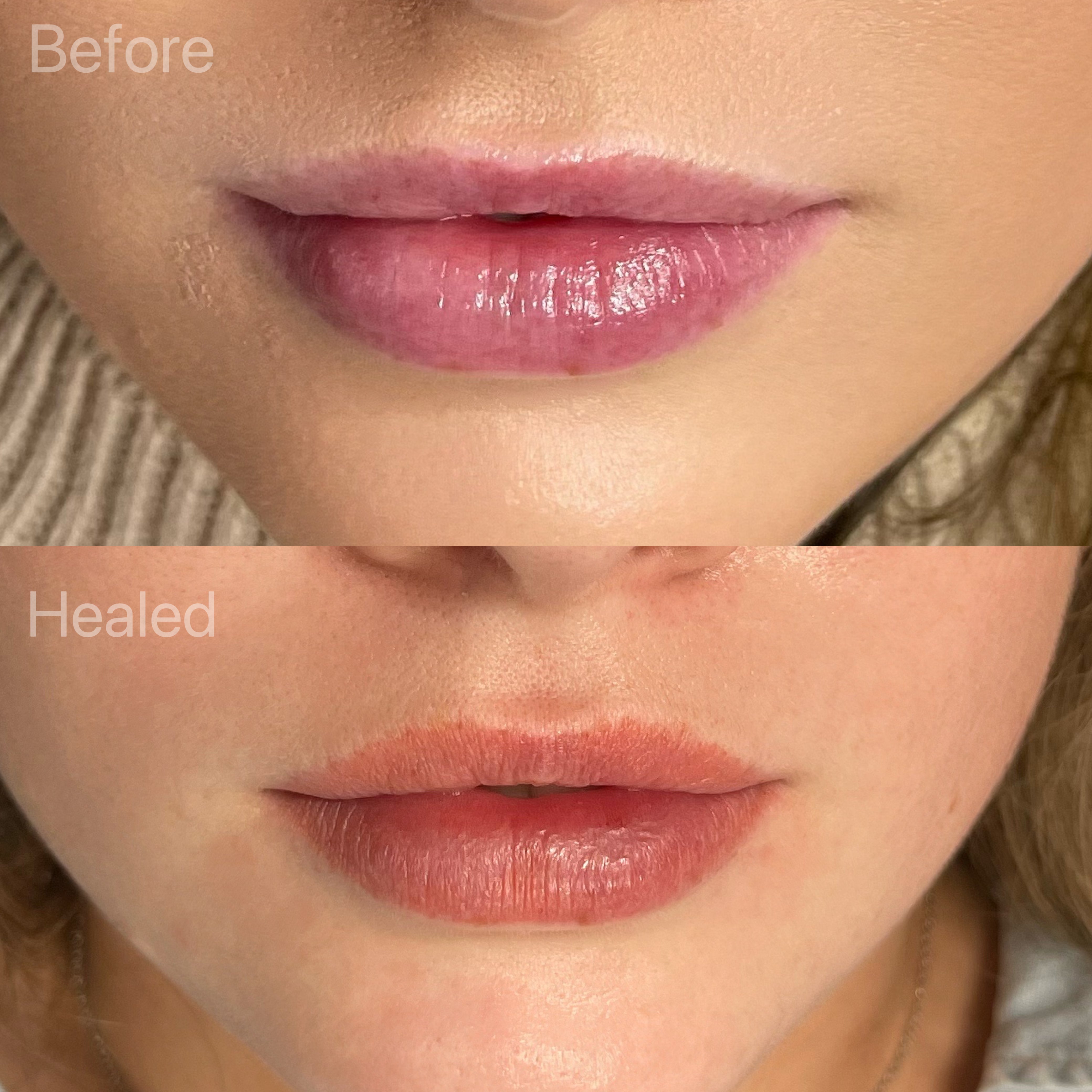 Details 67+ cosmetic lip tattoo healing process latest 